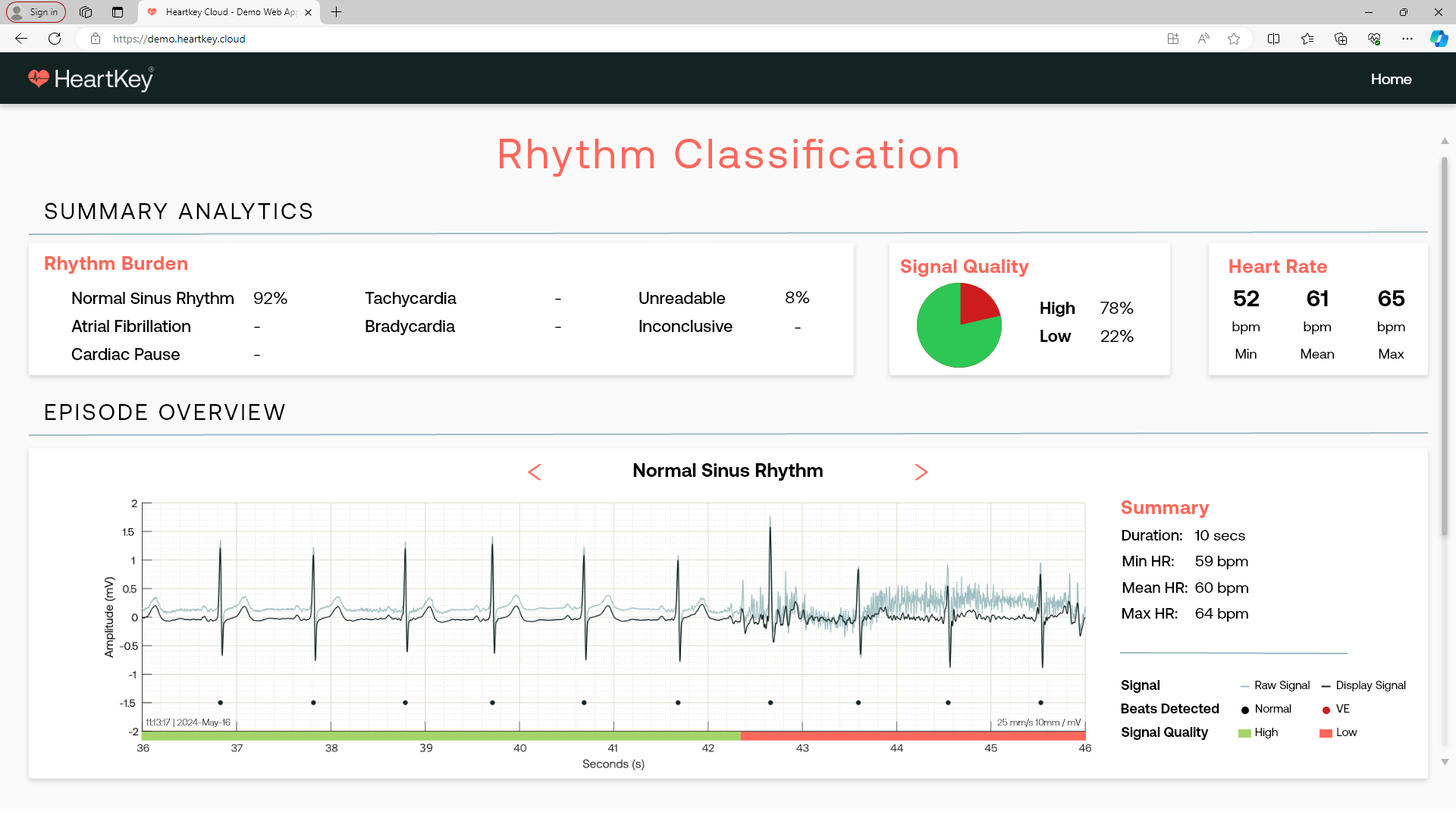 Example Web App Rhythm NSR